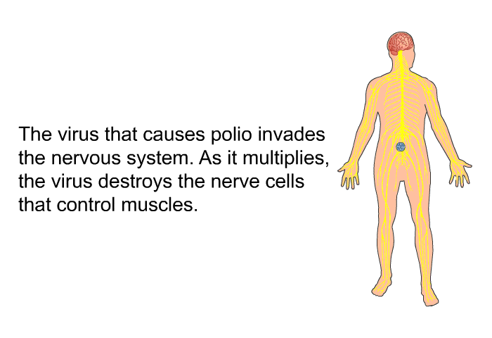 The virus that causes polio invades the nervous system. As it multiplies, the virus destroys the nerve cells that control muscles.