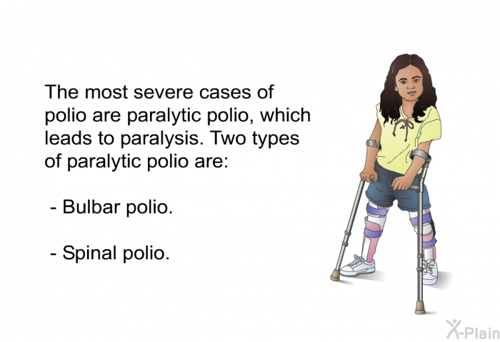 The most severe cases of polio are paralytic polio, which leads to paralysis. Two types of paralytic polio are:  Bulbar polio. Spinal polio.