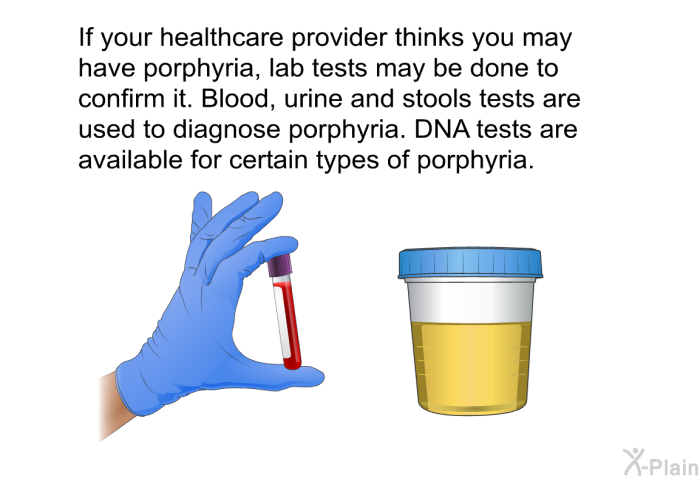 If your healthcare provider thinks you may have porphyria, lab tests may be done to confirm it. Blood, urine and stools tests are used to diagnose porphyria. DNA tests are available for certain types of porphyria.