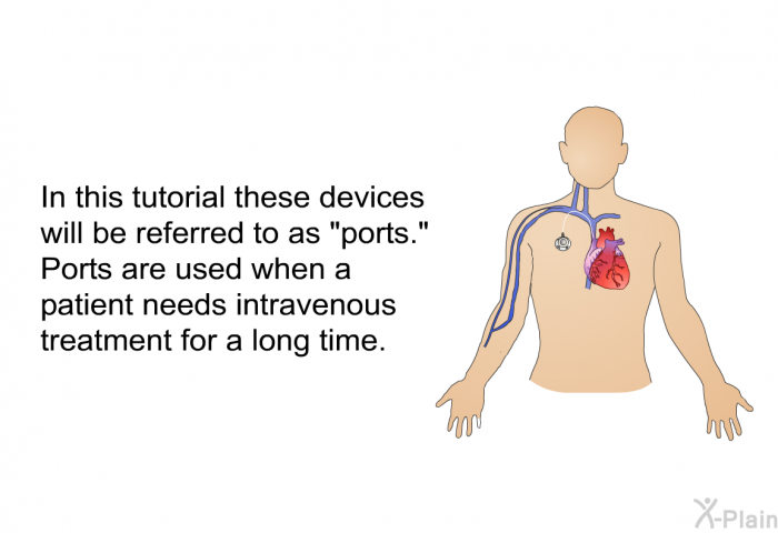 In this text, these devices will be referred to as “ports.” Ports are used when a patient needs intravenous treatment for a long time.