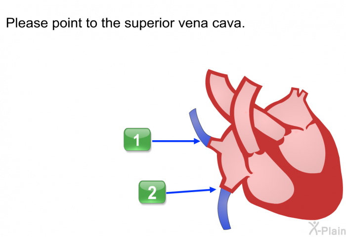 Please point to the superior vena cava. Press A or B