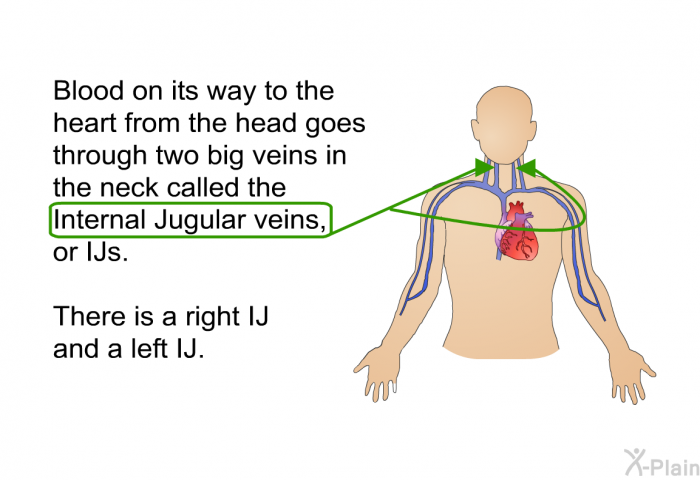 Blood on its way to the heart from the head goes through two big veins in the neck called the Internal Jugular veins, or IJs. There is a right IJ and a left IJ.