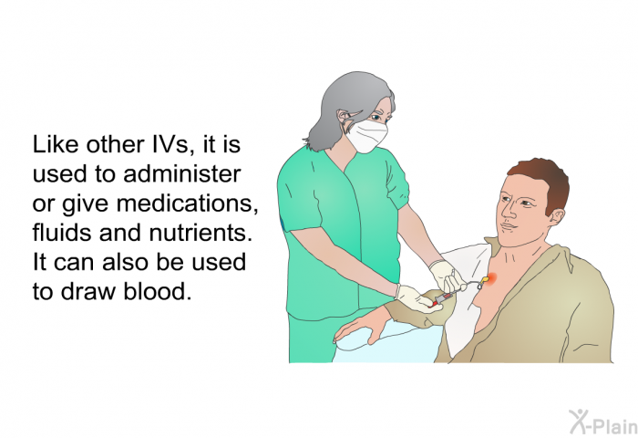 Like other IVs, it is used to administer or give medications, fluids and nutrients. It can also be used to draw blood.