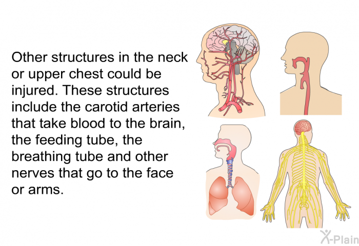 Other structures in the neck or upper chest could be injured. These structures include the carotid arteries that take blood to the brain, the feeding tube, the breathing tube and other nerves that go to the face or arms.