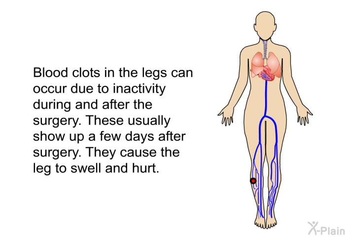 Blood clots in the legs can occur due to inactivity during and after the surgery. These usually show up a few days after surgery. They cause the leg to swell and hurt.