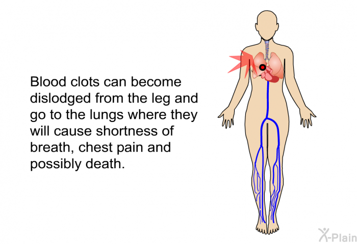 Blood clots can become dislodged from the leg and go to the lungs where they will cause shortness of breath, chest pain and possibly death.