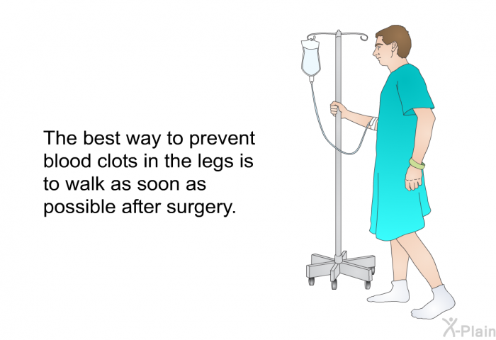 The best way to prevent blood clots in the legs is to walk as soon as possible after surgery.