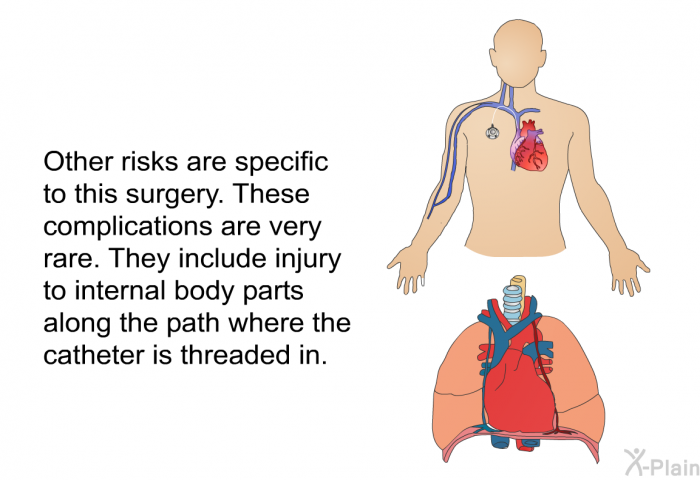 Other risks are specific to this surgery. These complications are very rare. They include injury to internal body parts along the path where the catheter is threaded in.