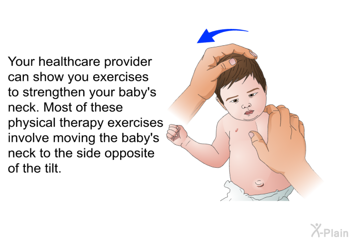 Your healthcare provider can show you exercises to strengthen your baby's neck. Most of these physical therapy exercises involve moving the baby's neck to the side opposite of the tilt.