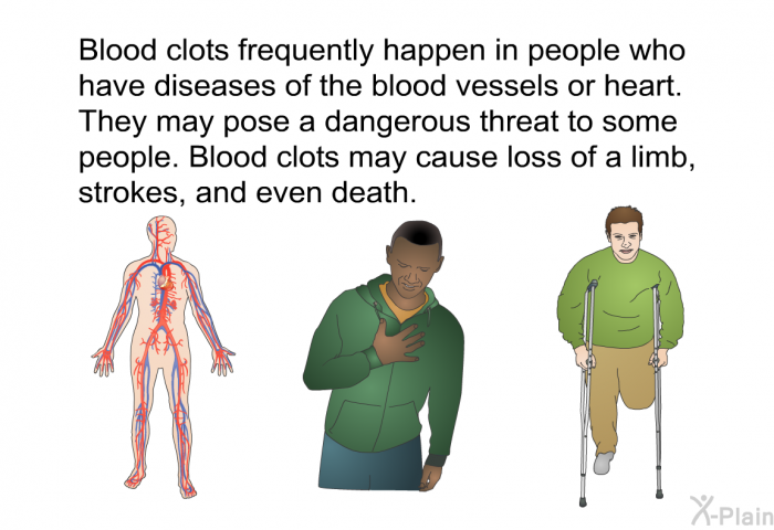 Blood clots frequently happen in people who have diseases of the blood vessels or heart. They may pose a dangerous threat to some people. Blood clots may cause loss of a limb, strokes, and even death.