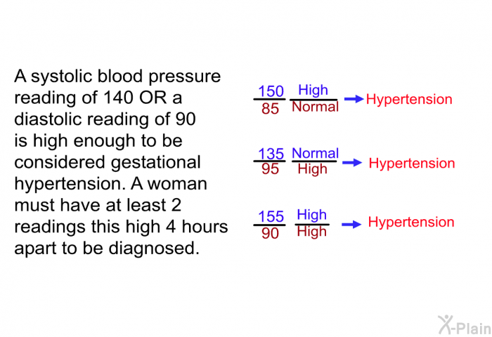 A systolic blood pressure reading of 140 OR a diastolic reading of 90 is high enough to be considered gestational hypertension. A woman must have at least 2 readings this high 4 hours apart to be diagnosed.