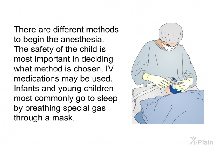 There are different methods to begin the anesthesia. The safety of the child is most important in deciding what method is chosen. IV medications may be used. Infants and young children most commonly go to sleep by breathing special gas through a mask.