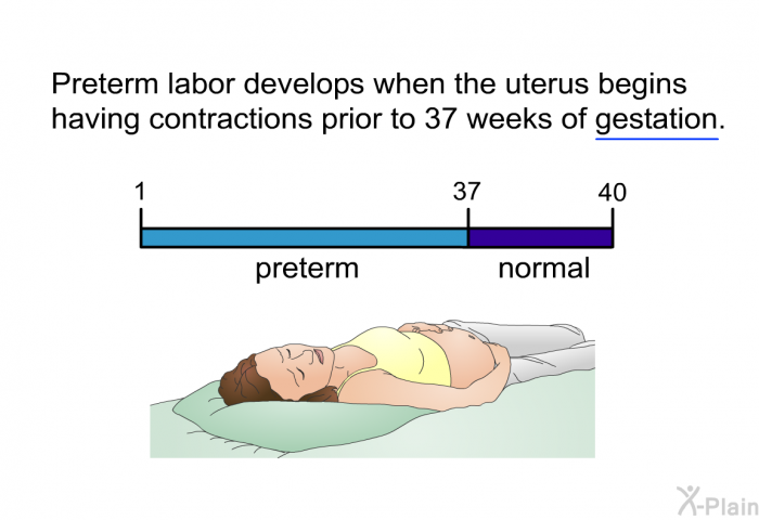 Preterm labor develops when the uterus begins having contractions prior to 37 weeks gestation.