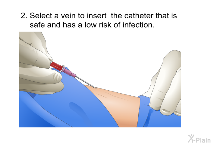 Select a vein to insert the catheter that is safe and has a low risk of infection.