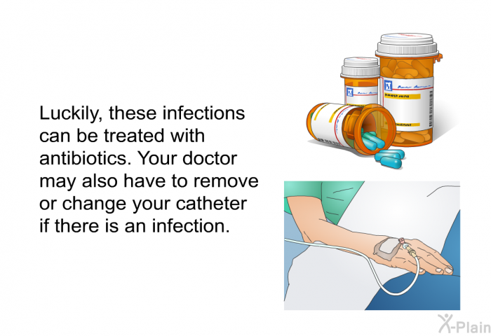 Luckily, these infections can be treated with antibiotics. Your doctor may also have to remove or change your catheter if there is an infection.