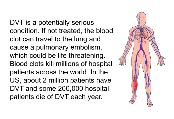DVT is a potentially serious condition. If not treated, the blood clot can travel to the lung and cause a pulmonary embolism, which could be life threatening. Blood clots kill millions of hospital patients across the world. In the US, about 2 million patients have DVT and some 200,000 hospital patients die of DVT each year.