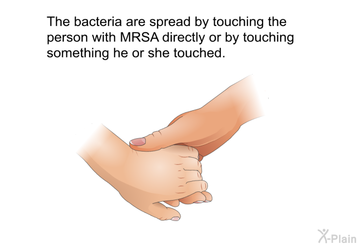 The bacteria are spread by touching the person with MRSA directly or by touching something he or she touched.