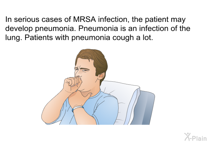 In serious cases of MRSA infection, the patient may develop pneumonia. Pneumonia is an infection of the lung. Patients with pneumonia cough a lot.
