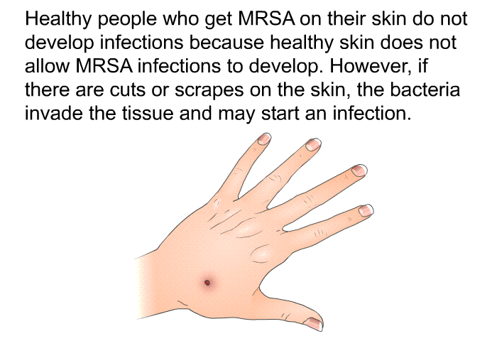 Healthy people who get MRSA on their skin do not develop infections because healthy skin does not allow MRSA infections to develop. However, if there are cuts or scrapes on the skin, the bacteria invade the tissue and may start an infection.