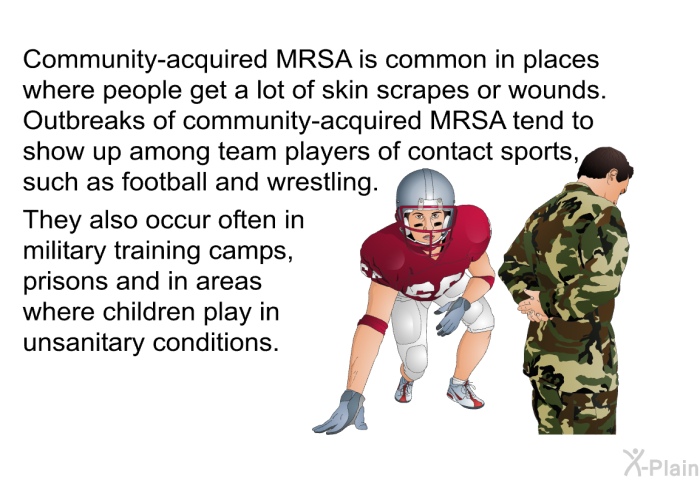 Community-acquired MRSA is common in places where people get a lot of skin scrapes or wounds. Outbreaks of community-acquired MRSA tend to show up among team players of contact sports, such as football and wrestling. They also occur often in military training camps, prisons and in areas where children play in unsanitary conditions.