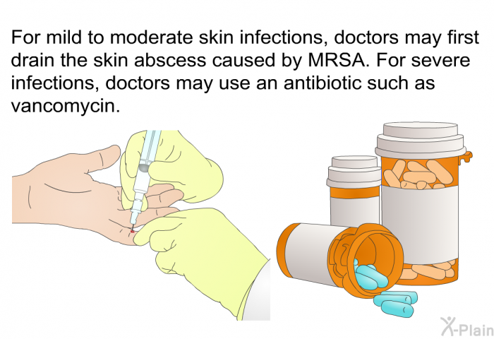 For mild to moderate skin infections, doctors may first drain the skin abscess caused by MRSA. For severe infections, doctors may use an antibiotic such as vancomycin.