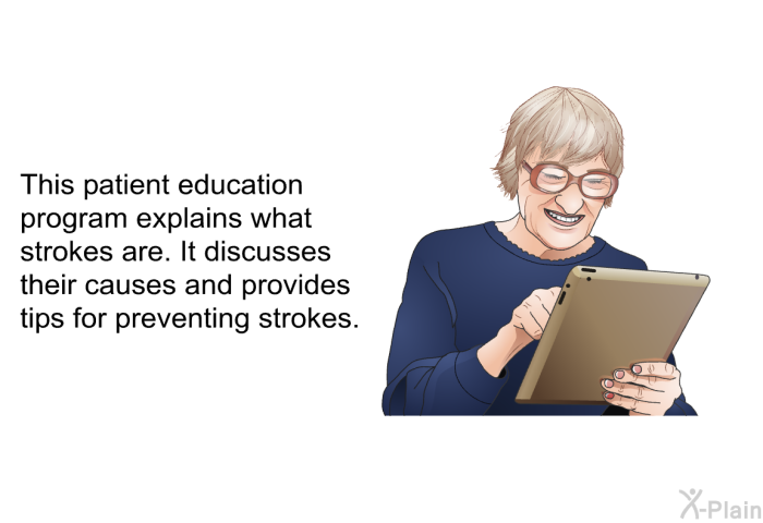 This health information explains what strokes are. It discusses their causes and provides tips for preventing strokes.