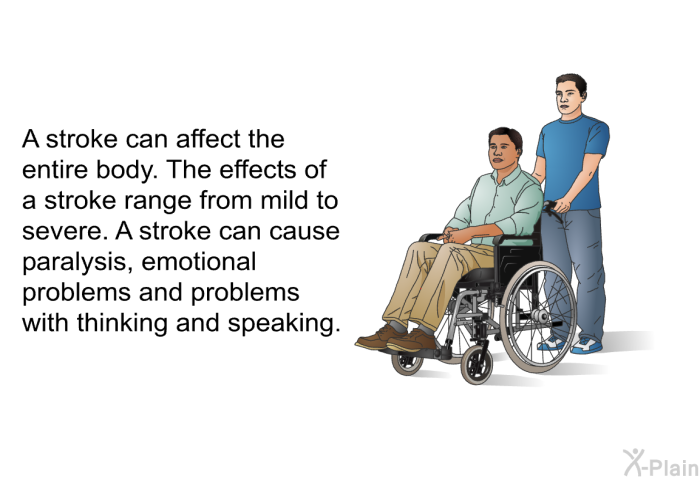 A stroke can affect the entire body. The effects of a stroke range from mild to severe. A stroke can cause paralysis, emotional problems and problems with thinking and speaking.
