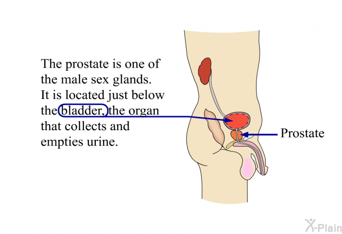 The prostate is one of the male sex glands. It is located just below the bladder, the organ that collects and empties urine.