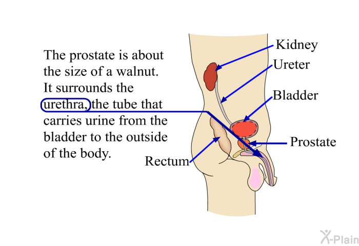The prostate is about the size of a walnut. It surrounds the urethra, the tube that carries urine from the bladder to the outside of the body.