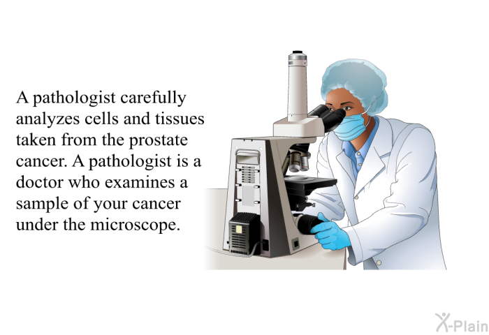 A pathologist carefully analyzes cells and tissues taken from the prostate cancer. A pathologist is a doctor who examines a sample of your cancer under the microscope.