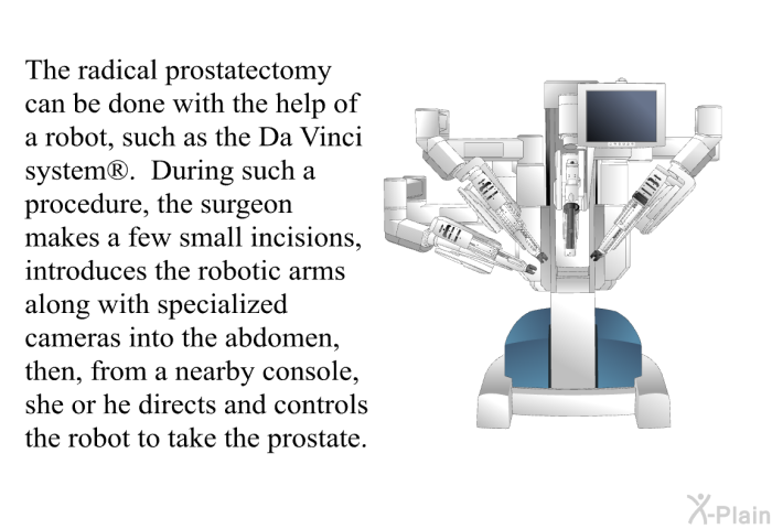 The radical prostatectomy can be done with the help of a robot, such as the Da Vinci system<SUP> </SUP>. During such a procedure, the surgeon makes a few small incisions, introduces the robotic arms along with specialized cameras into the abdomen, then, from a nearby console, she or he directs and controls the robot to take the prostate.