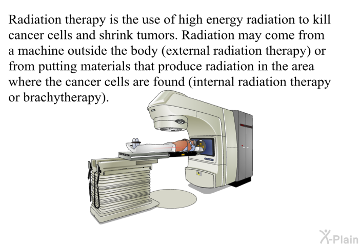Radiation therapy is the use of high energy radiation to kill cancer cells and shrink tumors. Radiation may come from a machine outside the body (external radiation therapy) or from putting materials that produce radiation in the area where the cancer cells are found (internal radiation therapy or brachytherapy).