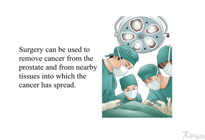 Surgery can be used to remove cancer from the prostate and from nearby tissues into which the cancer has spread.