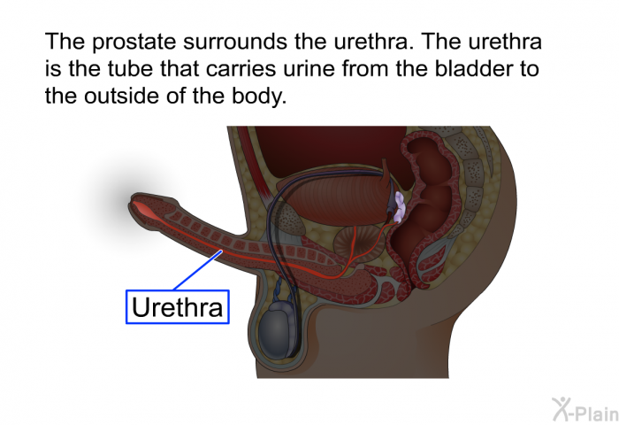 The prostate surrounds the urethra. The urethra is the tube that carries urine from the bladder to the outside of the body.