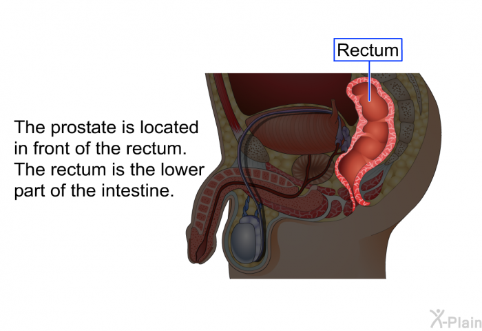 The prostate is located in front of the rectum. The rectum is the lower part of the intestine.