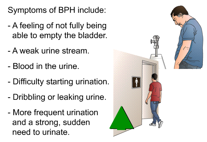 Symptoms of BPH include:  A feeling of not fully being able to empty the bladder. A weak urine stream. Blood in the urine. Difficulty starting urination. Dribbling or leaking urine. More frequent urination and a strong, sudden need to urinate.