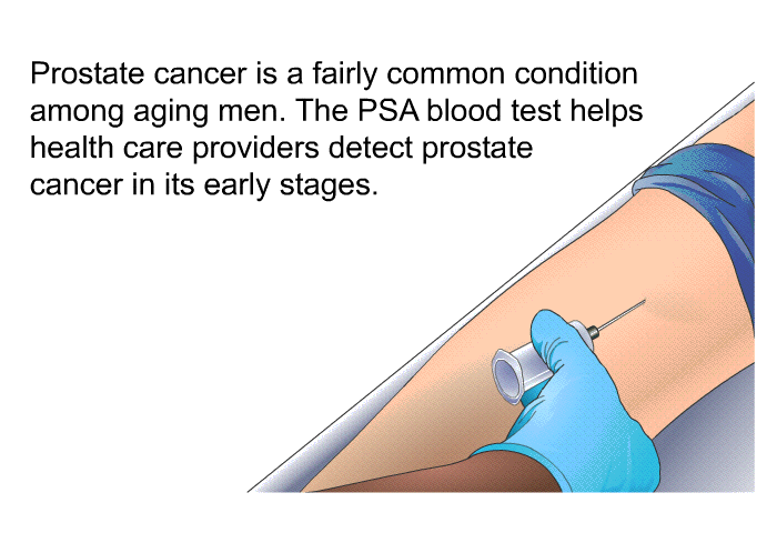 Prostate cancer is a fairly common condition among aging men. The PSA blood test helps health care providers detect prostate cancer in its early stages.