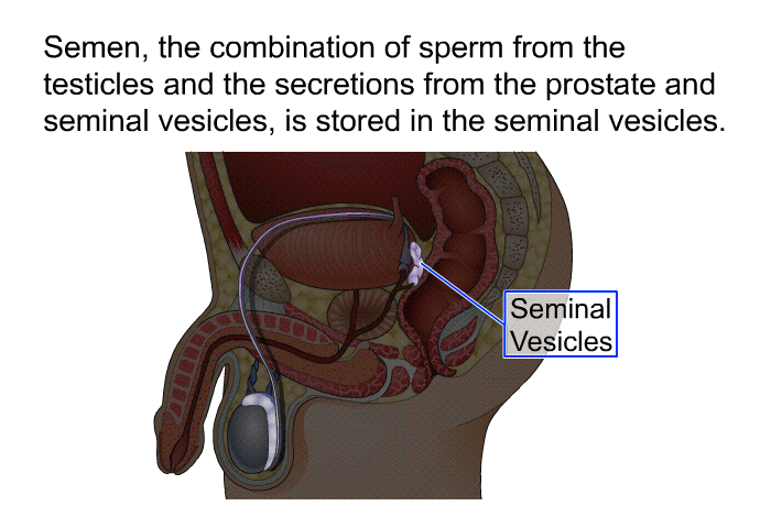 Semen, the combination of sperm from the testicles and the secretions from the prostate and seminal vesicles, is stored in the seminal vesicles.