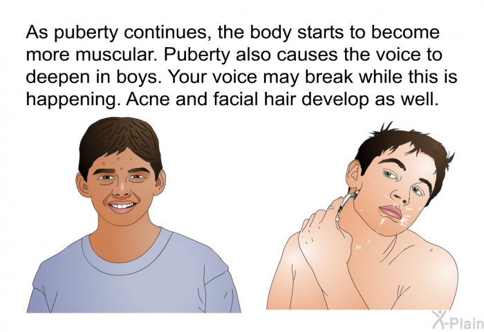 As puberty continues, the body starts to become more muscular. Puberty also causes the voice to deepen in boys. Your voice may break while this is happening. Acne and facial hair develop as well.