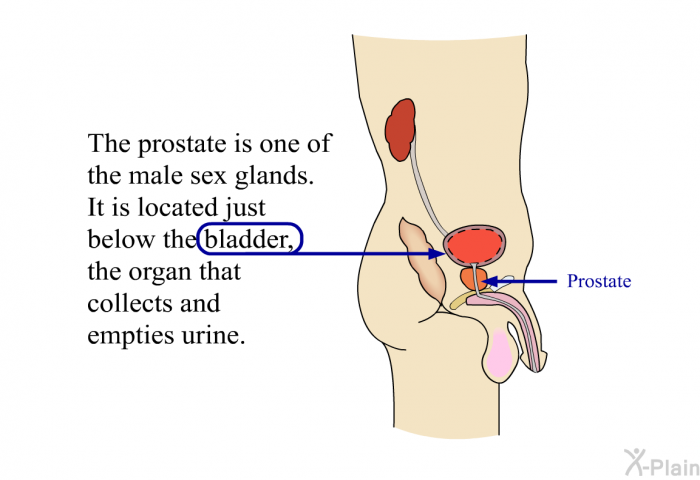 The prostate is one of the male sex glands. It is located just below the bladder, the organ that collects and empties urine.