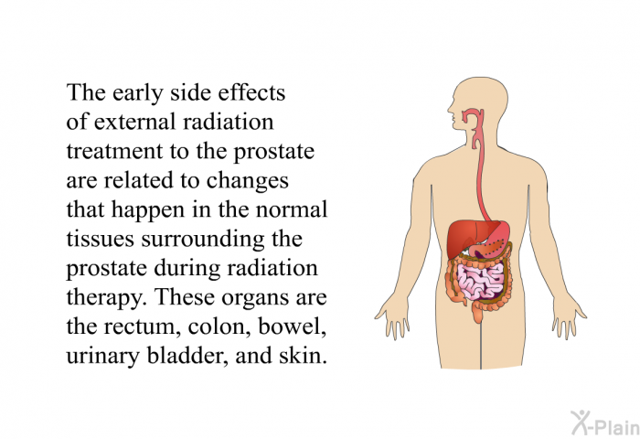 The early side effects of external radiation treatment to the prostate are related to changes that happen in the normal tissues surrounding the prostate during radiation therapy. These organs are the rectum, colon, bowel, urinary bladder, and skin.