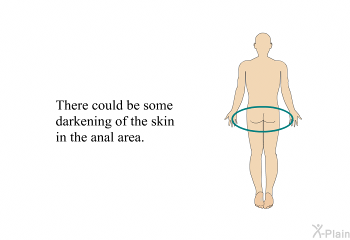 There could be some darkening of the skin in the anal area.