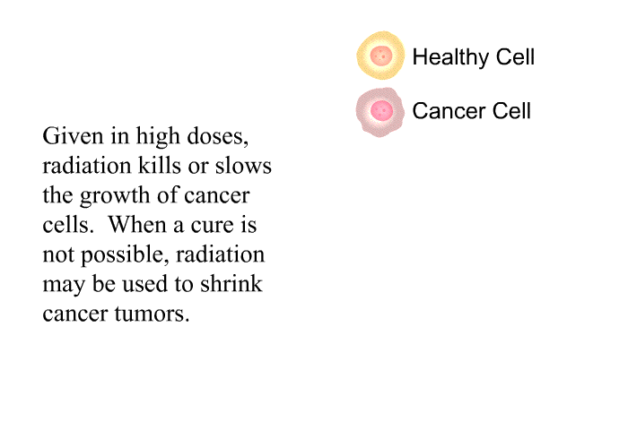 Given in high doses, radiation kills or slows the growth of cancer cells. When a cure is not possible, radiation may be used to shrink cancer tumors.