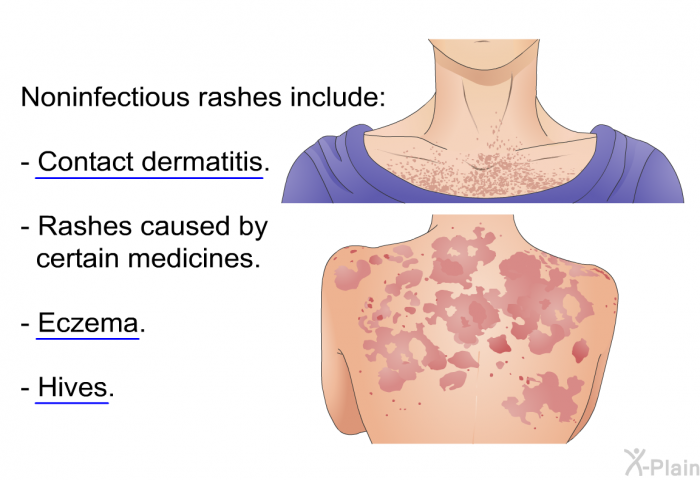 Noninfectious rashes include:  Contact dermatitis. Rashes caused by certain medicines. Eczema. Hives.