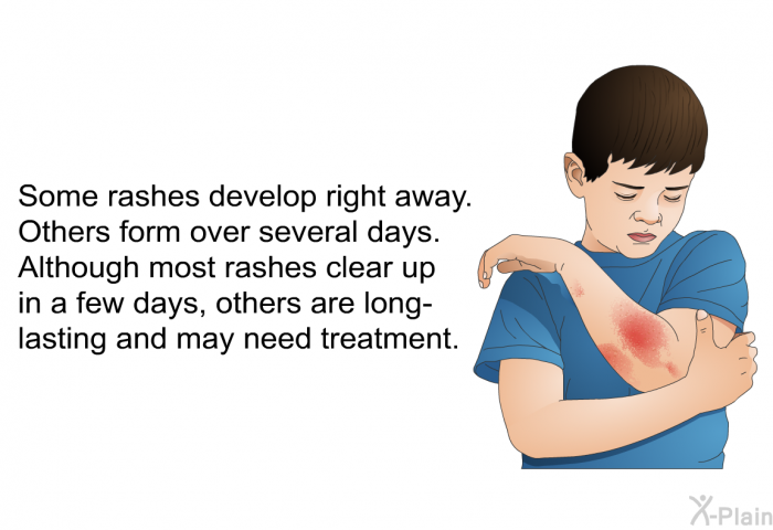 Some rashes develop right away. Others form over several days. Although most rashes clear up in a few days, others are long-lasting and may need treatment.