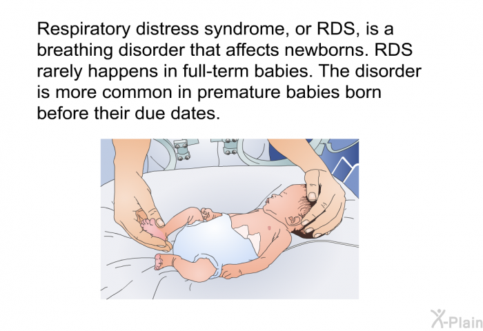 Respiratory distress syndrome, or RDS, is a breathing disorder that affects newborns. RDS rarely happens in full-term babies. The disorder is more common in premature babies born before their due dates.