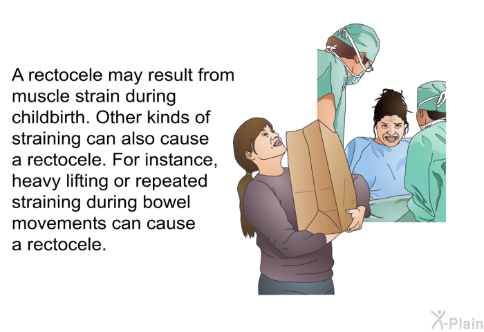 A rectocele may result from muscle strain during childbirth. Other kinds of straining can also cause a rectocele. For instance, heavy lifting or repeated straining during bowel movements can cause a rectocele.