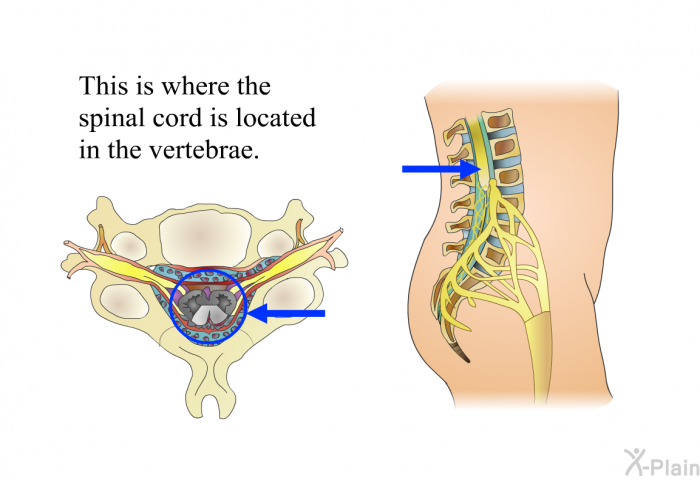 This is where the spinal cord is located in the vertebrae.