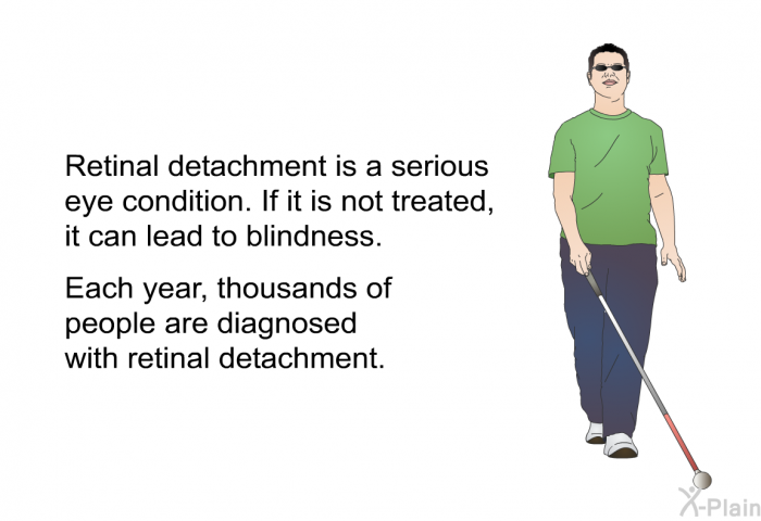 Retinal detachment is a serious eye condition. If it is not treated, it can lead to blindness. Each year, thousands of people are diagnosed with retinal detachment.