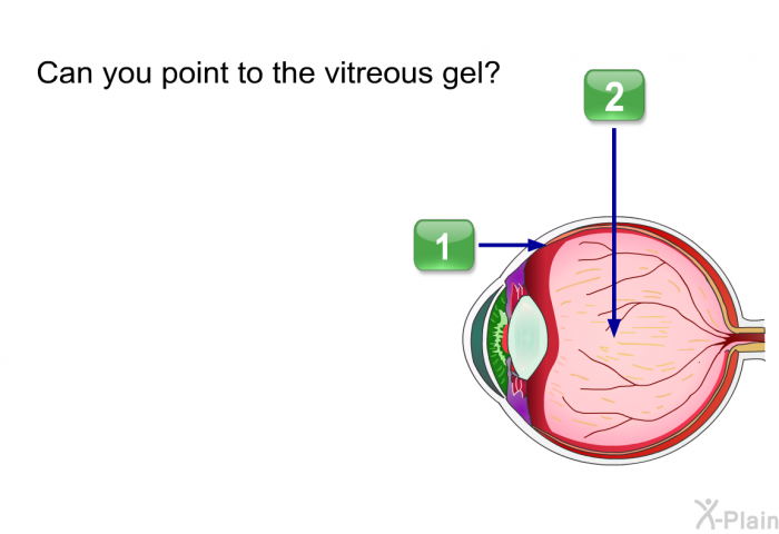 Can you point to the vitreous gel?